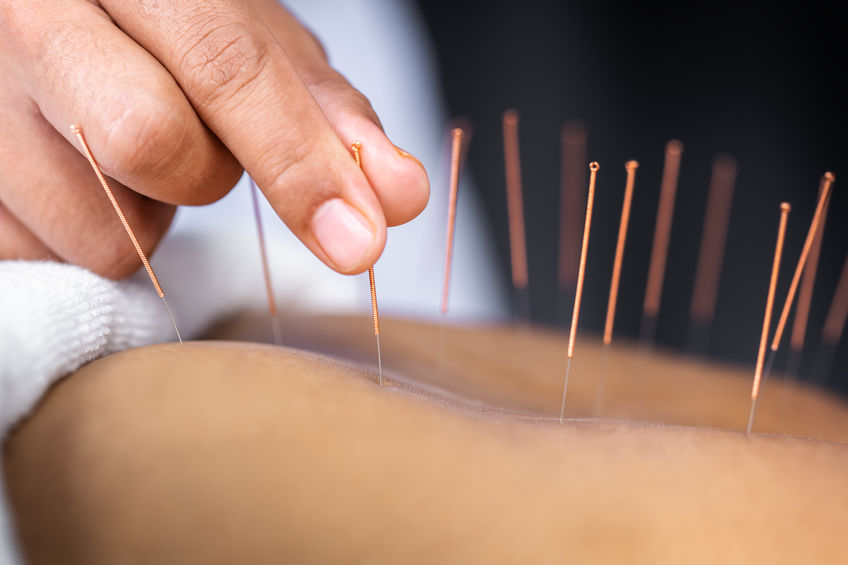 Acupuncture & Accupressure Clinic